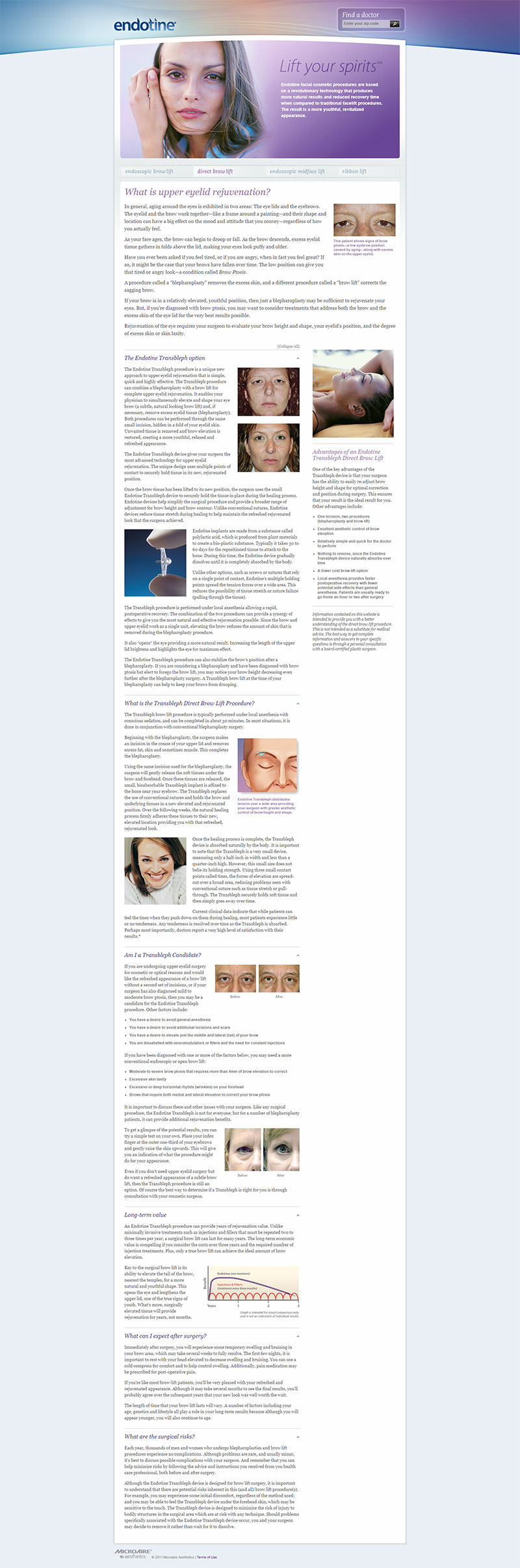 previous design of facelift webpage for bleph implant