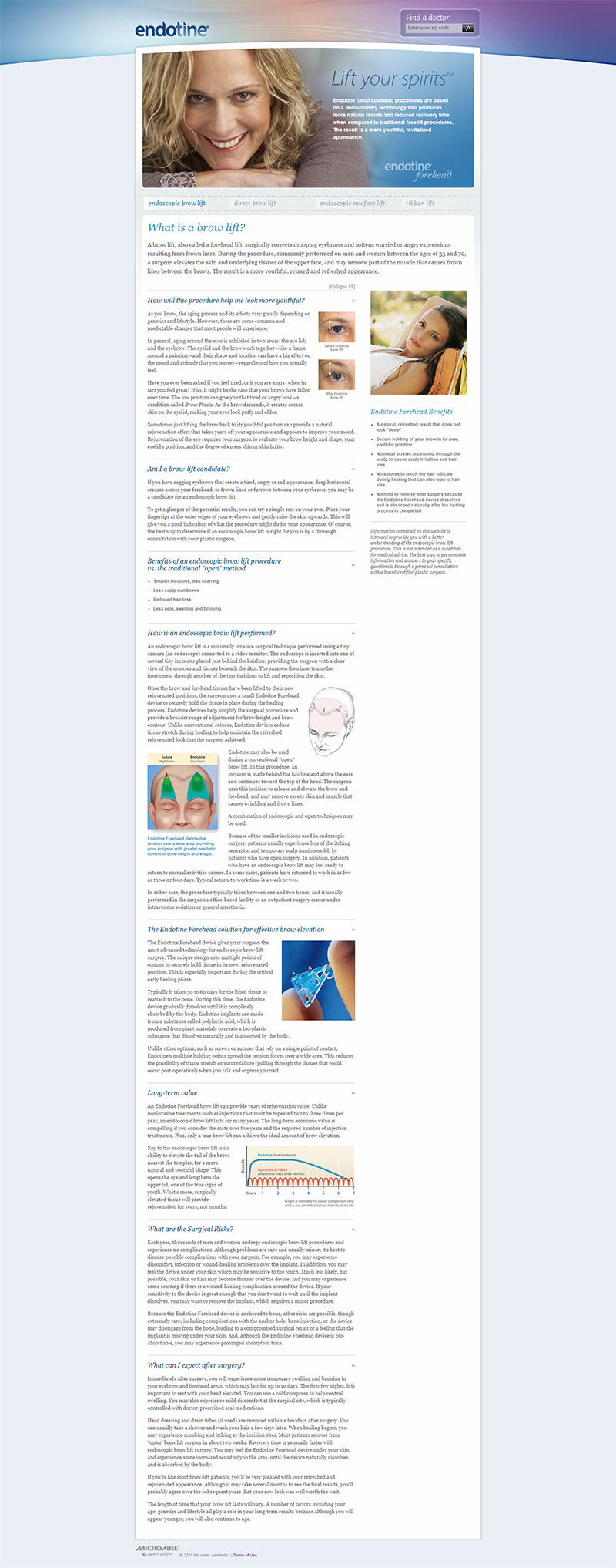 previous design of facelift webpage for forehead implant