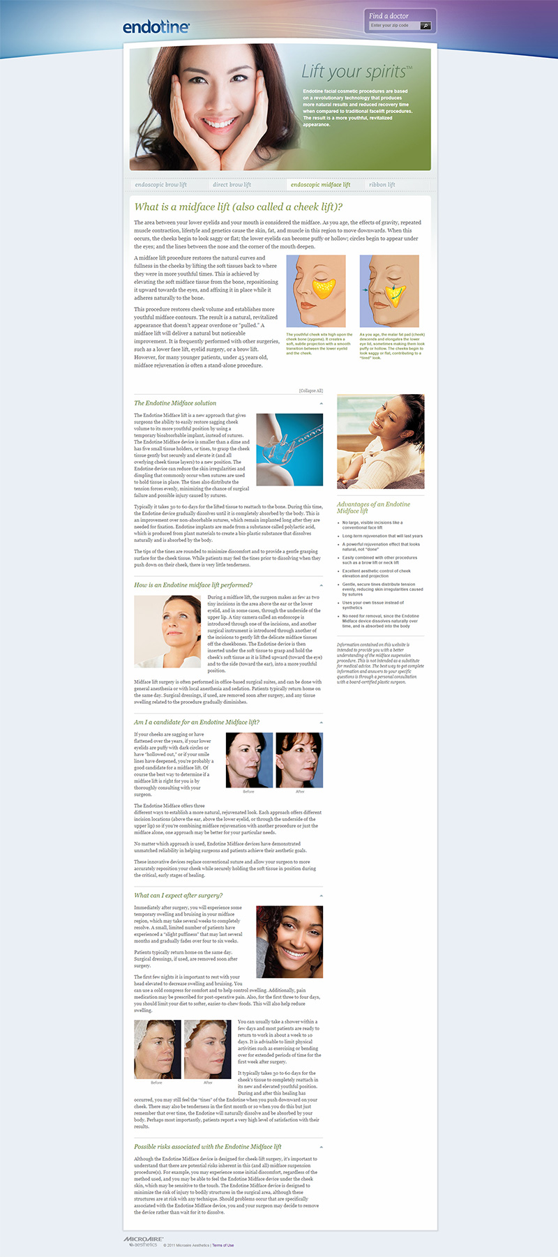 previous design of facelift webpage for cheek implant