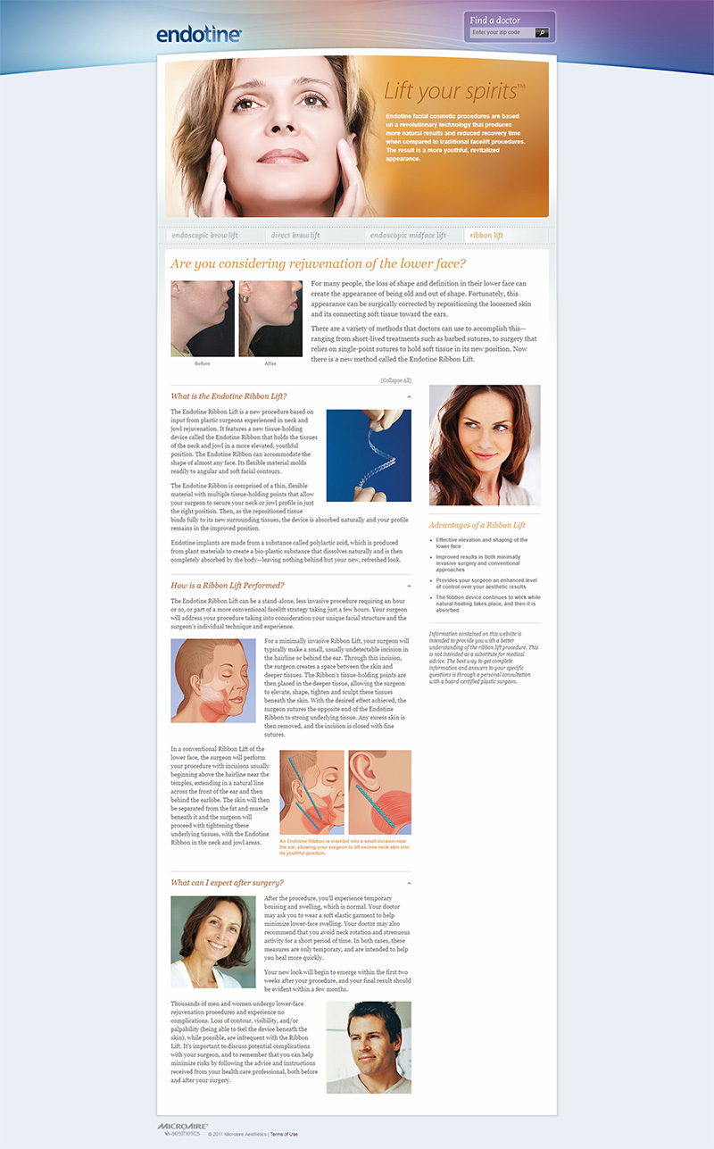 previous design of facelift webpage for neck implant